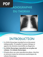 Download TD Radio thorax Normale by Doc Zak SN74029716 doc pdf