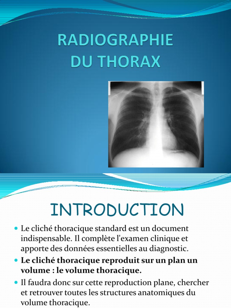 TD Radio Thorax Normale PDF Médecine Anatomie humaine