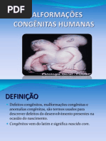 MALFORMAÇÕES CONGÊNITAS HUMANAS