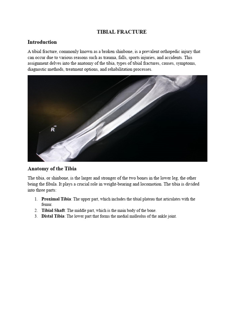 TIBIAL FRACTURE | Download Free PDF | Ankle | Human Leg