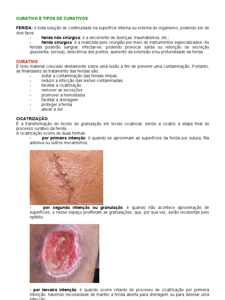 Tipos e Técnicas de Curativos para Feridas | PDF | Infecção ...