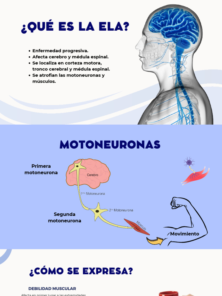 Comprendiendo la ELA y su impacto | PDF | Medicina CLINICA | Medicina