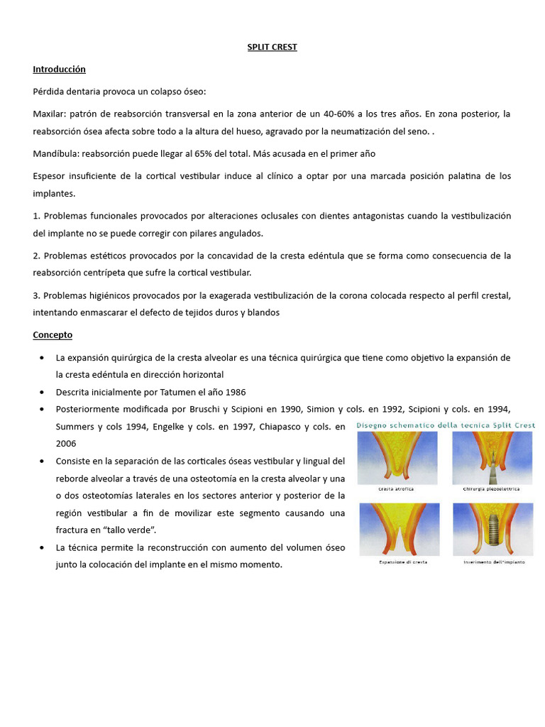 Técnica Split Crest en Implantología Dental | PDF | Hueso