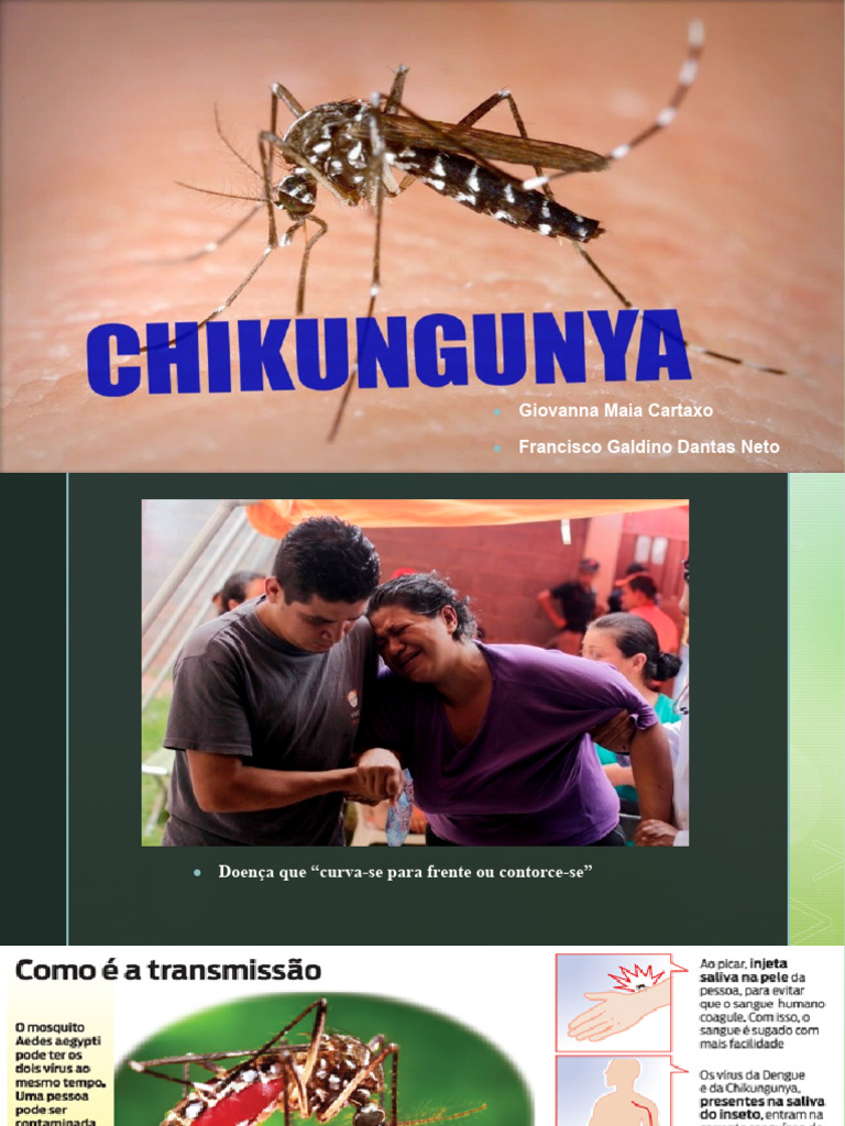 Apresentação Chikungunya | PDF | Artrite | Inflamação