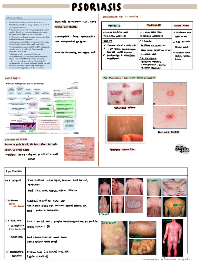 Panduan Diagnosa dan Terapi Psoriasis | PDF