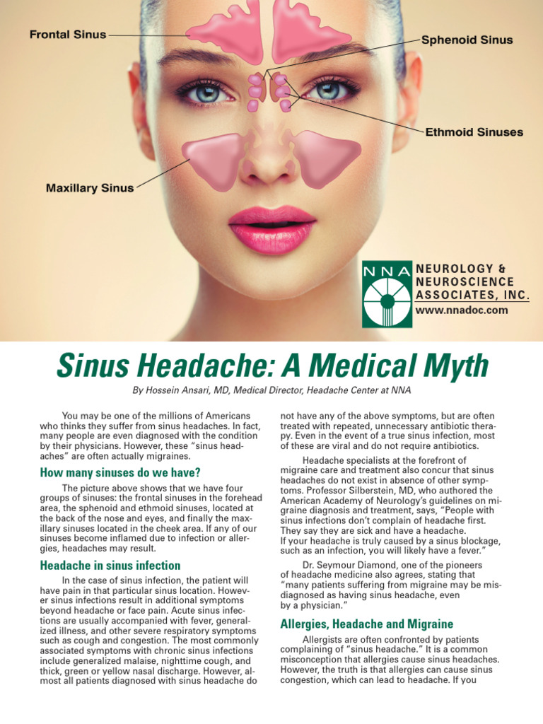 The sinus headache myth download free pdf headache migraine