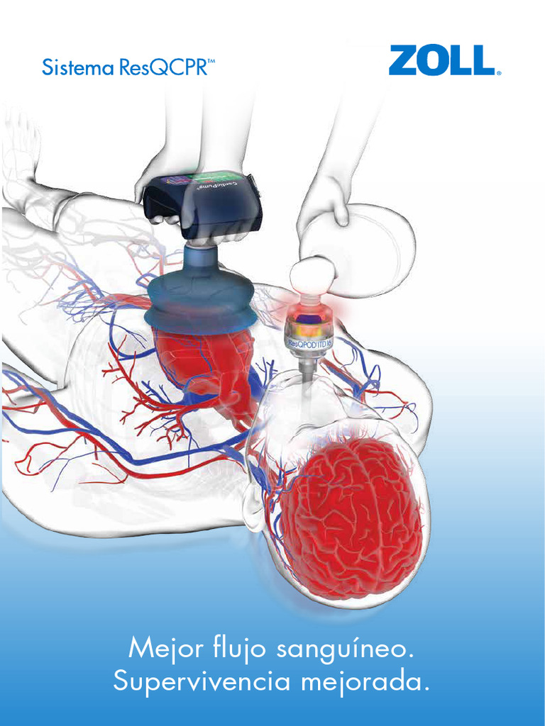 Cardiopump System Brochure Es | PDF | Reanimación cardiopulmonar ...