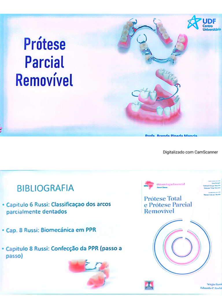 Prótese PPR | PDF