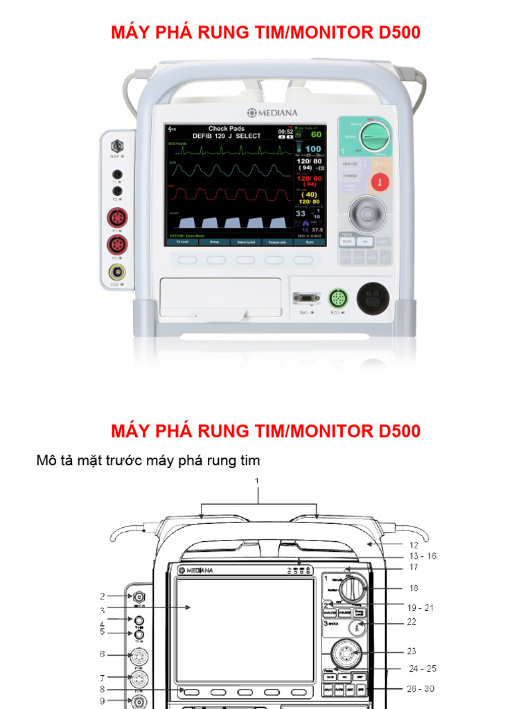 Máy phá rung tim (trinh chieu) | PDF