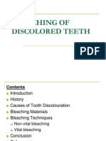 Bleeching of Discolored Teeth