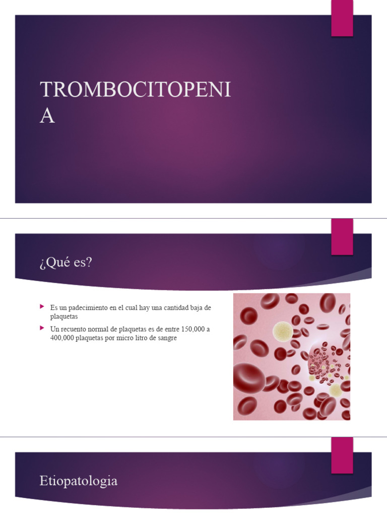 Guía sobre Trombocitopenia: Causas y Tratamiento | PDF