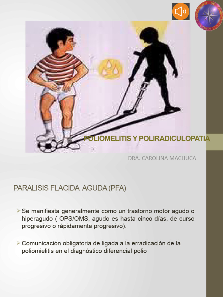 Poliomyelitis y Parálisis Flácida Aguda | PDF | Especialidades Medicas