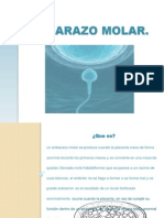 Embarazo Molar