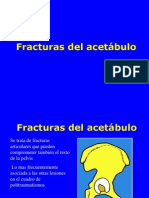 04 - Fracturas de Acetabulo