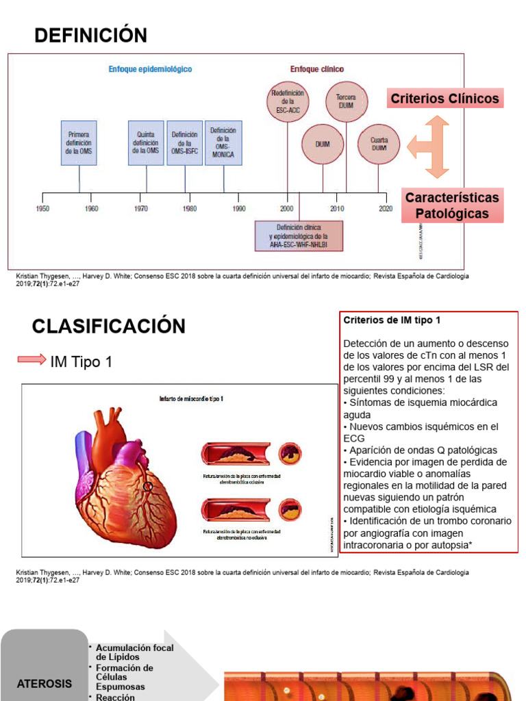 SCA_1RA_PARTE | PDF | Infarto de miocardio | Isquemia
