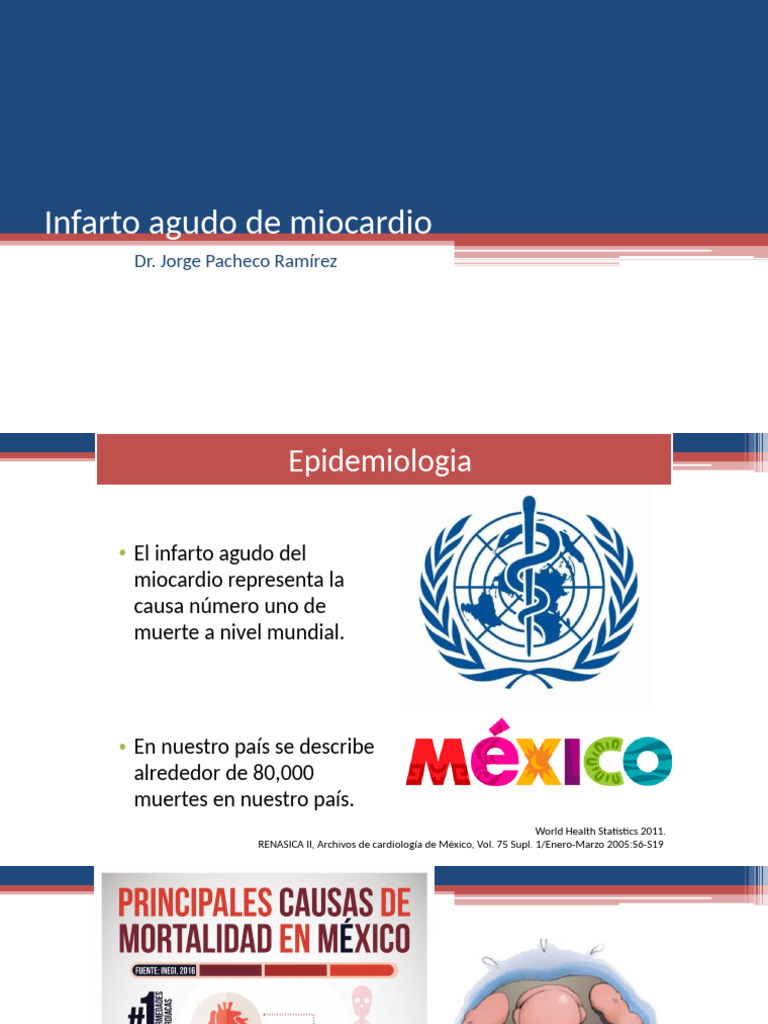 Infarto Agudo de Miocardio: Causas y Tratamiento | PDF | Infarto de ...