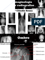 Aula 2 imaginologia por radiografias- ombro e cintura escapular. Profº Claudio Souza
