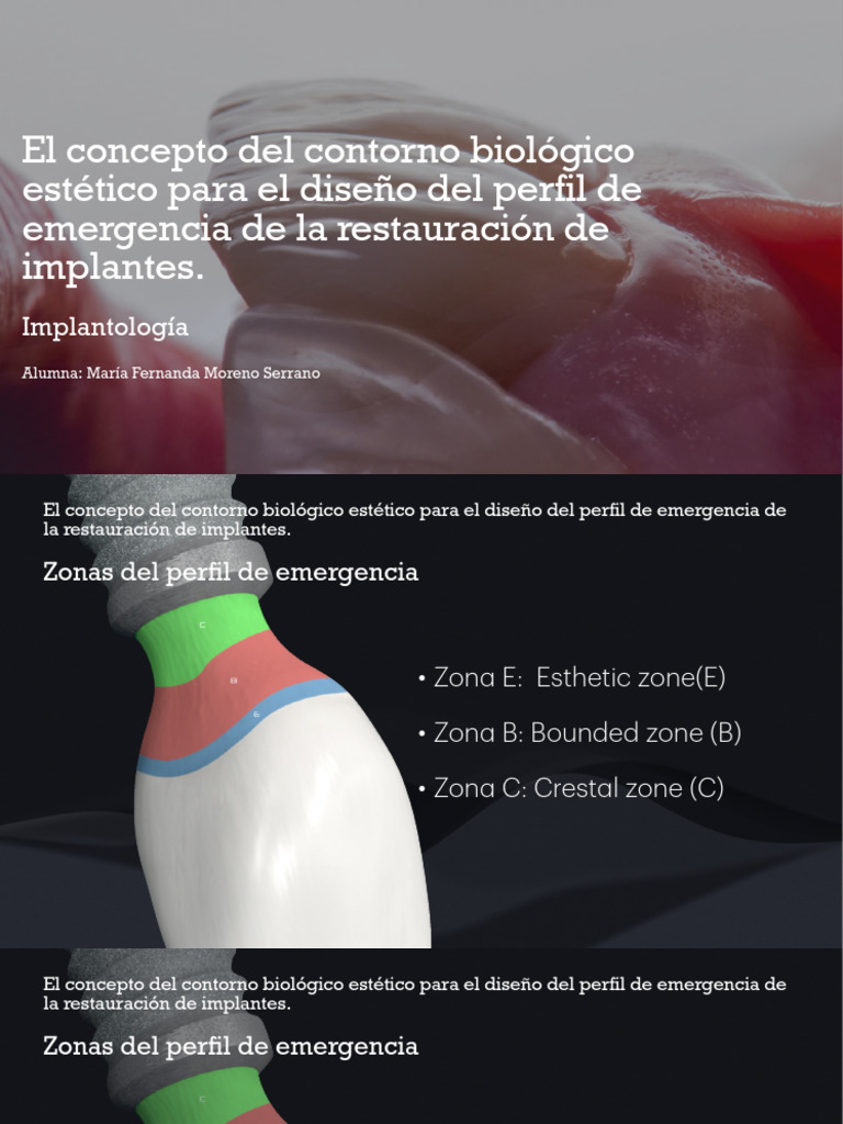 Diseño del perfil de emergencia en implantes | PDF