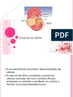 Cáncer de Riñón