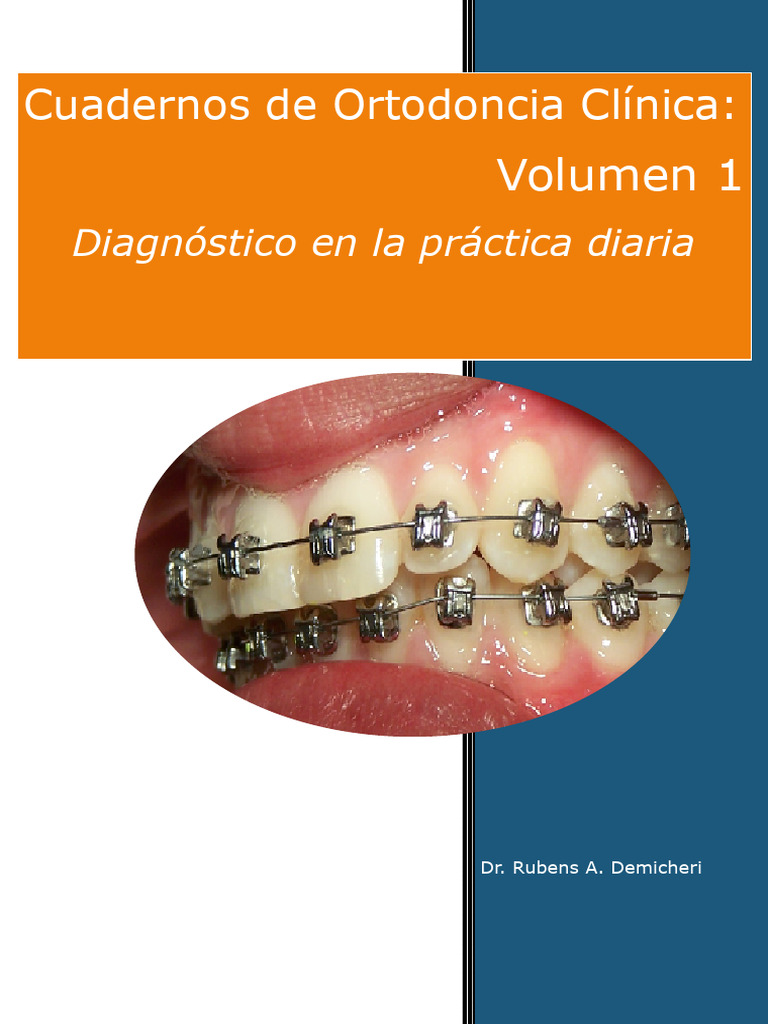 Diagnóstico y Planificación en Ortodoncia | PDF | Ortodoncia | Odontología