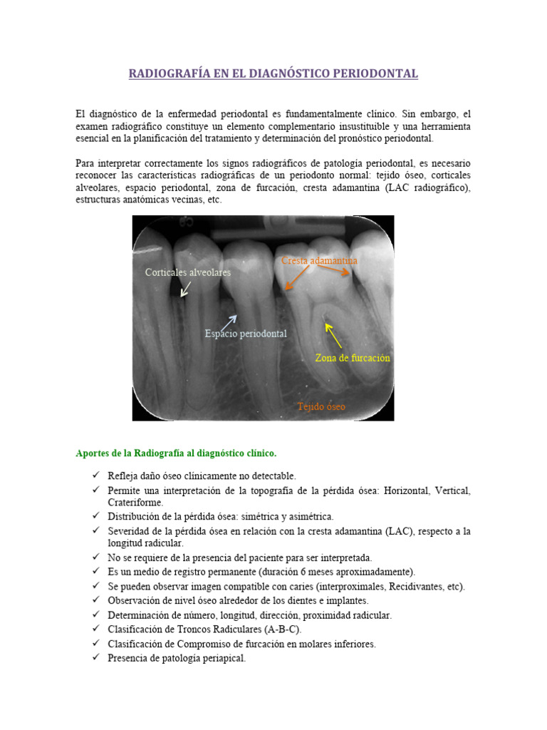 RX Periodontal | Descargar gratis PDF | Hueso | Diente