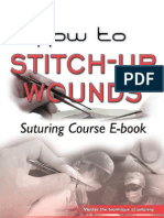 How to Stitch Up Wounds