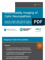 Multimodality Imaging Review of Optic Neuropathies
