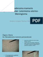 Fibroma Mamario - Leiomioma Uterino - Meningioma