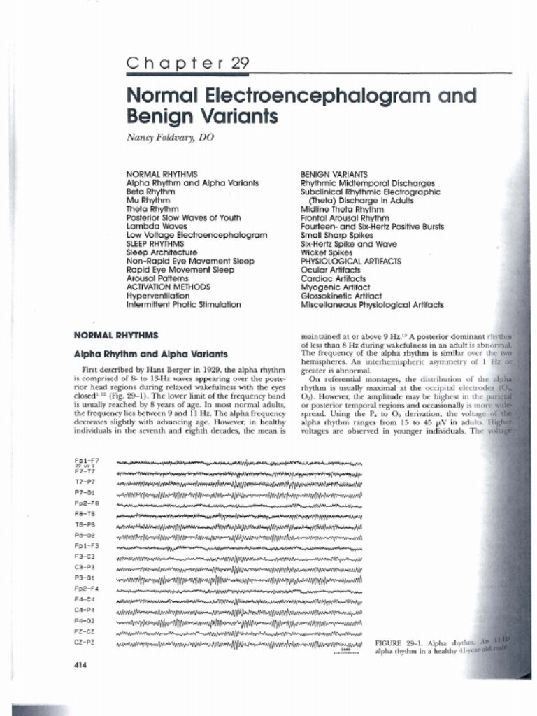 Lueders CH 29. Normal Electroencephalogram and Benign Variants | PDF