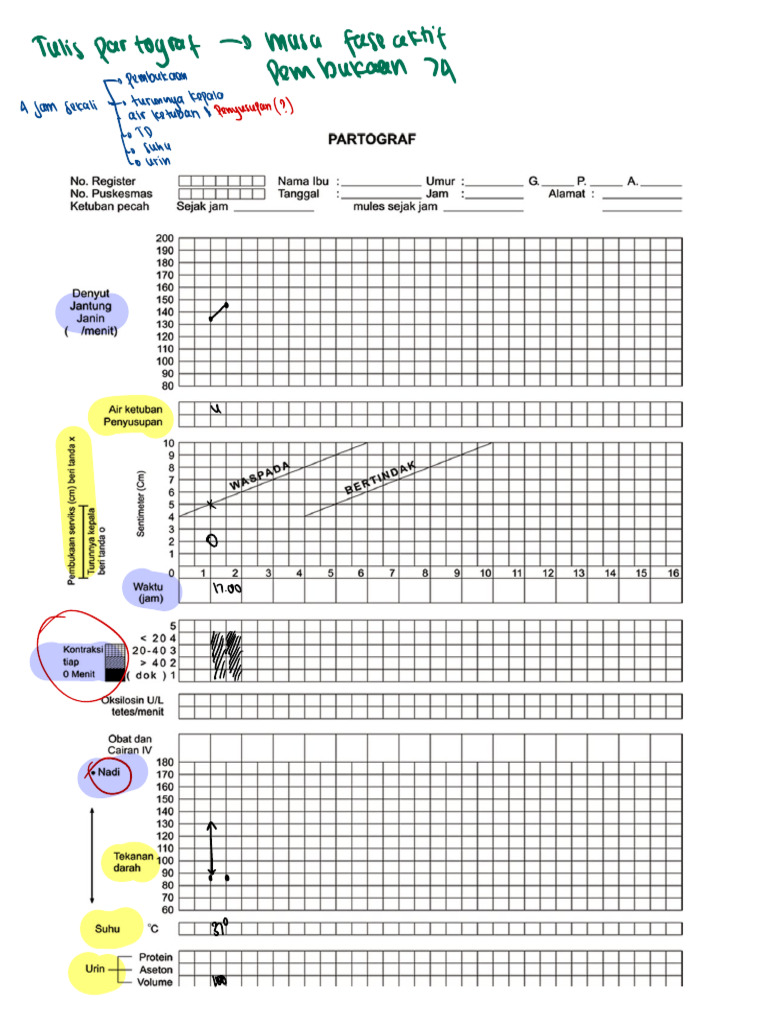 Partograf | PDF