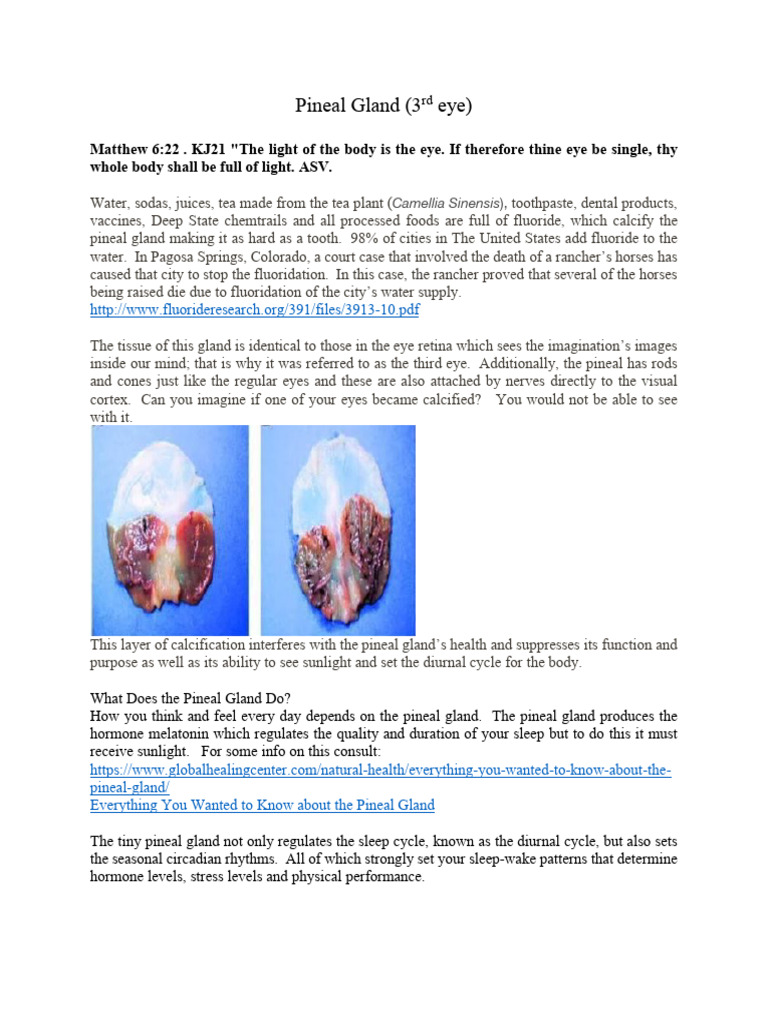 pineal-gland-3rd-eye-pdf-fluoride