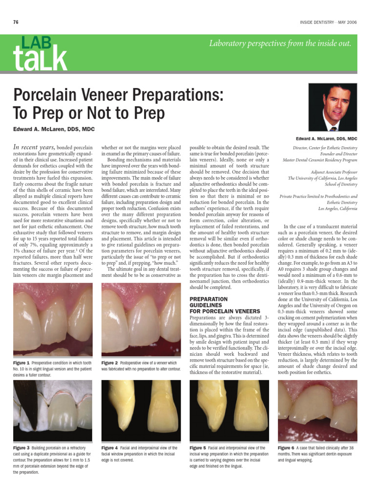 Porcelain Veneer Preparations PDF Young's Modulus Tooth Enamel