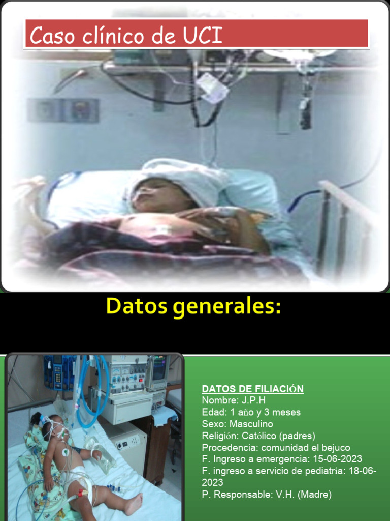 Tema 02 Neumonia En Pediatria Pdf Neumonía Influenza