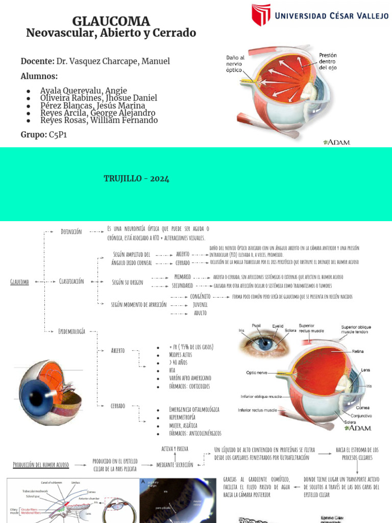 Glaucoma | PDF | Glaucoma | Ojo humano