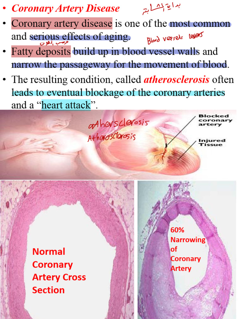 1 Cardiovascular Pathophysiology Pdf Atherosclerosis Heart