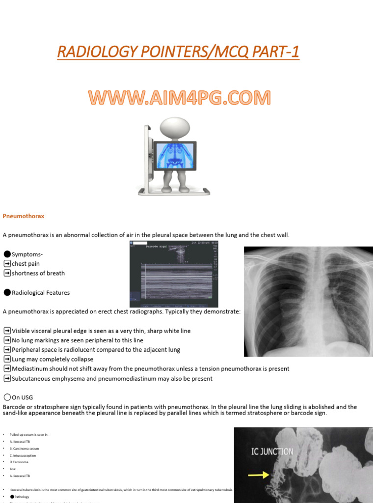 Radiology Insights: Pneumothorax & Obstruction | PDF | Clinical ...