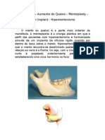 Mentoplastia