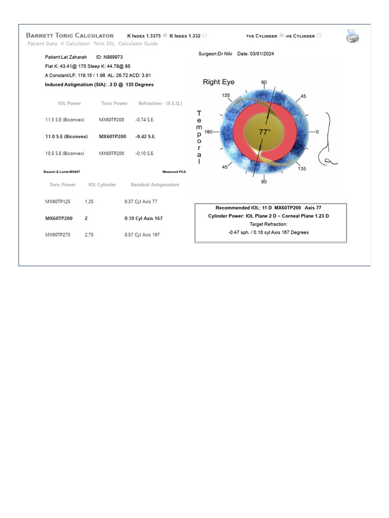 Barrett Toric IOL Calculator Results | PDF