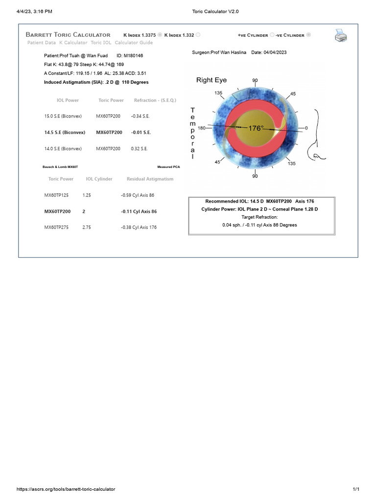 Barrett Toric Calculator - ASCRS | PDF