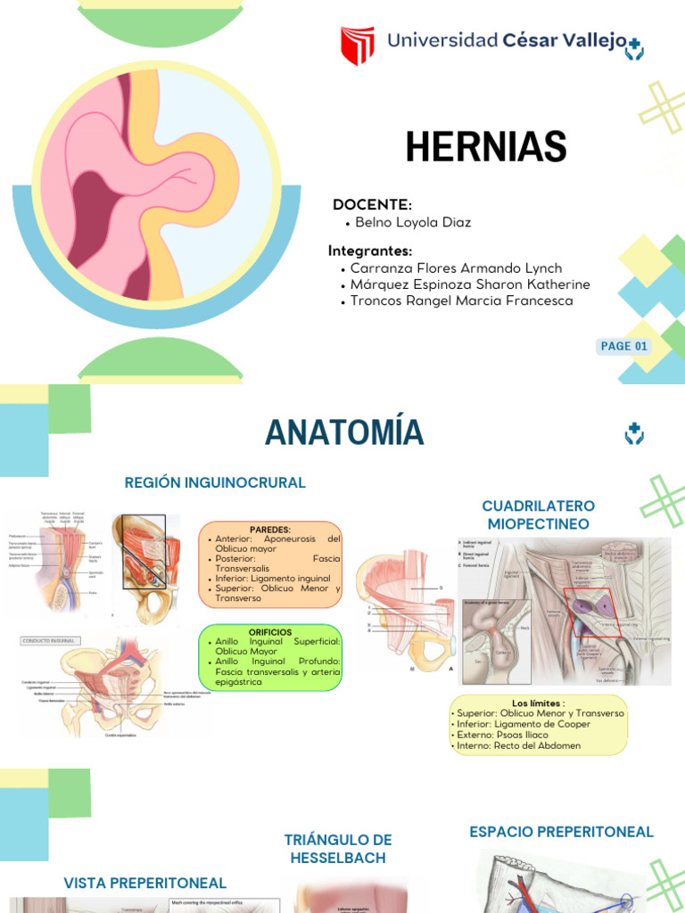 Clasificación y características de hernias | PDF | Abdomen