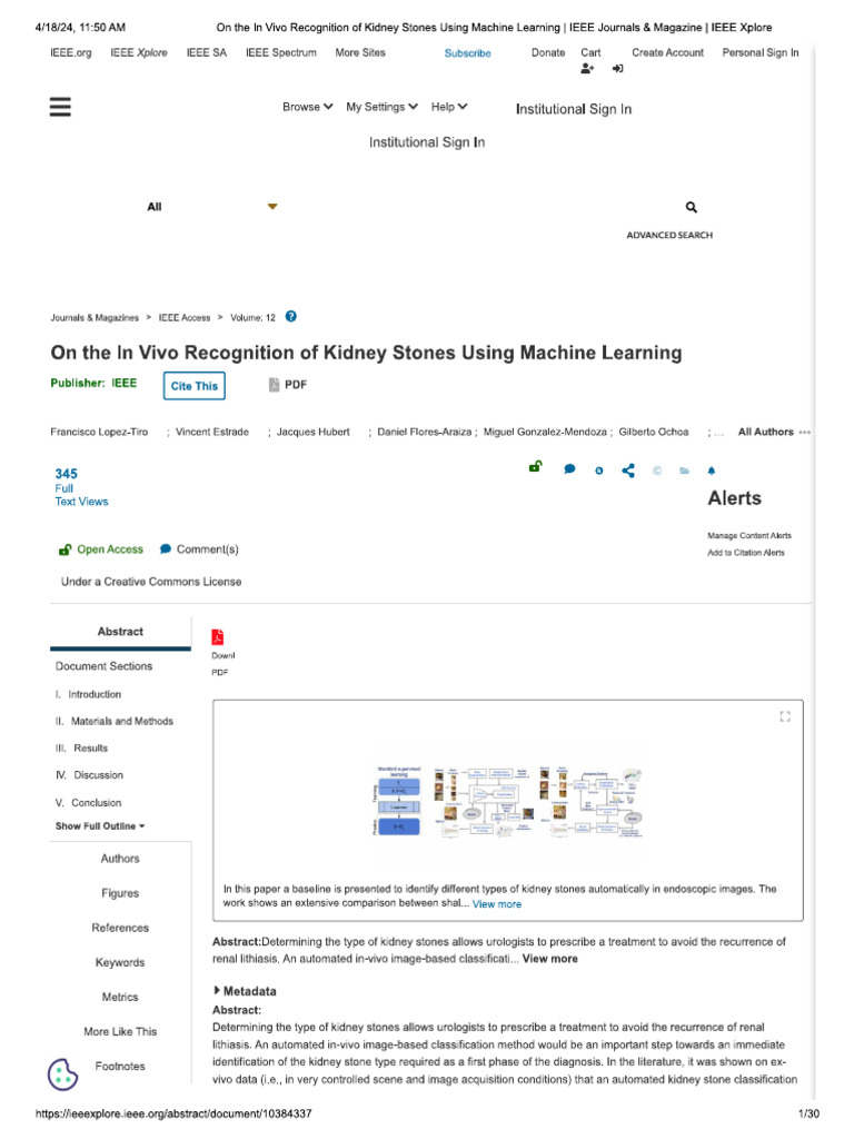 Kidney Stone Article 2 | PDF