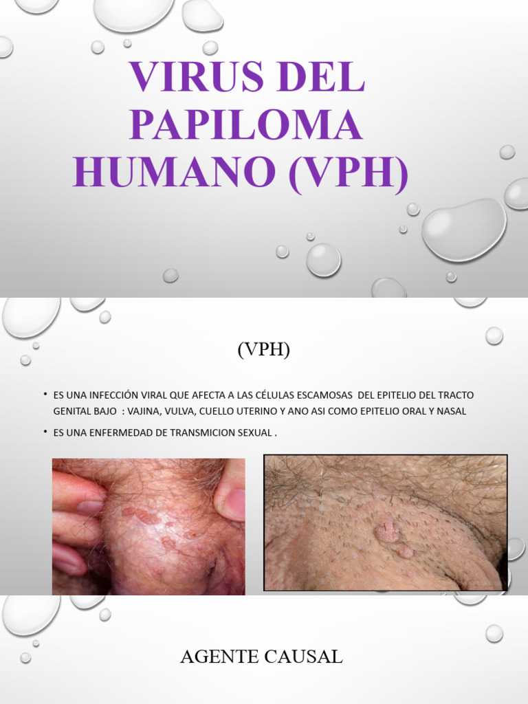 DIAPOSITIVA VPH | PDF