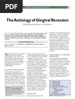 The Aetiology of Gingival Recession