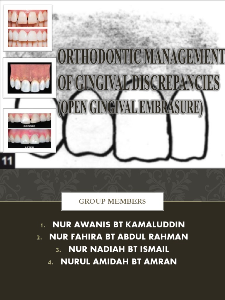 Perio | PDF