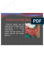 Flesh Eating Bacteria