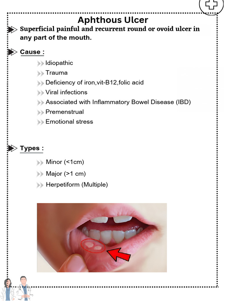Apthous Ulcer - 20231029 - 180303 - 0000 | PDF