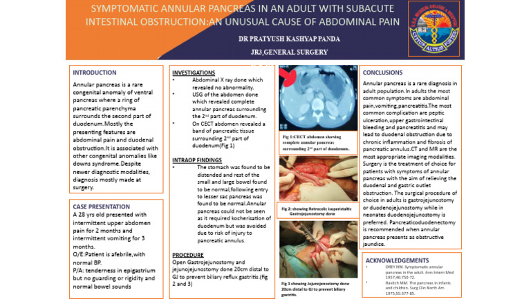 Osacicon Poster Annular Pancreas | PDF | Pancreas | Medical Specialties