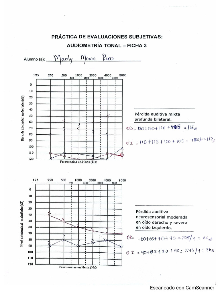 Ejercicio de Audiometria | PDF
