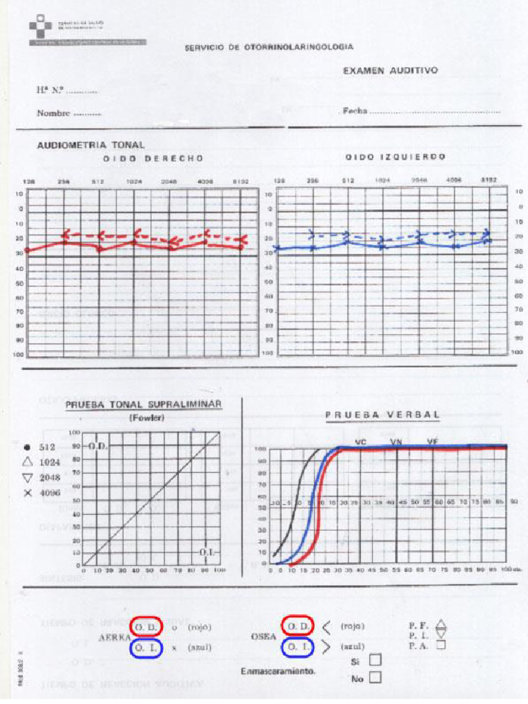 10 - Audiometría Tonal | PDF