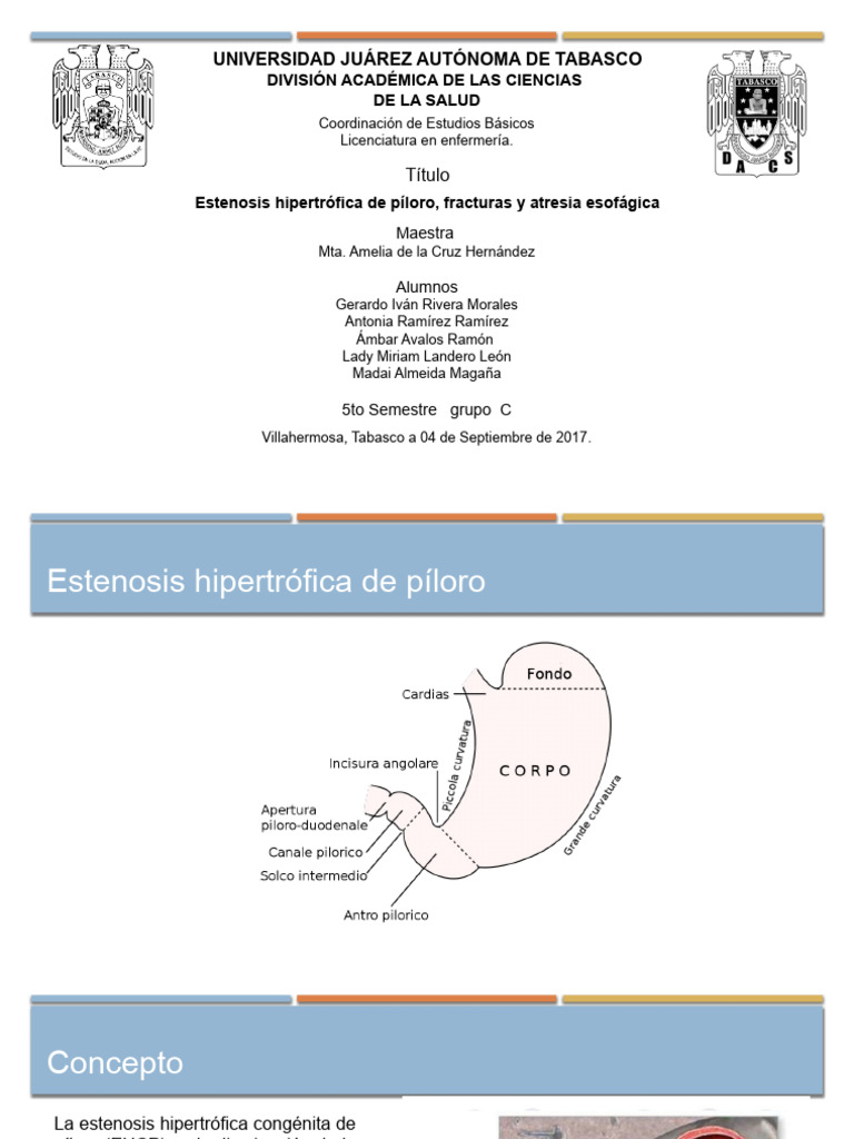 Guía Clínica: Estenosis Hipertrófica Píloro | PDF | Estómago ...